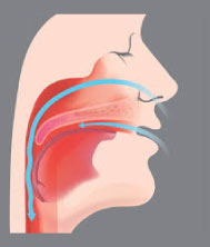 Snoring and Obstructive Sleep Apnea (OSA)