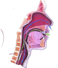 Laryngology (Voice)